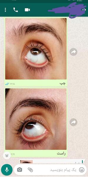 عکس چشم زن باردار نی نی سایت