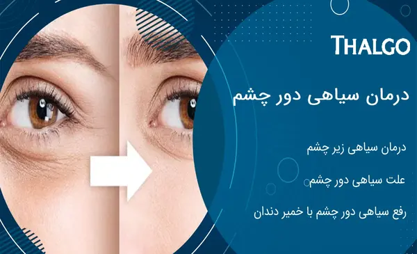 عکس چشم زن باردار نی نی سایت