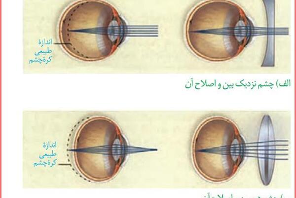 عکس چشم زیست یازدهم