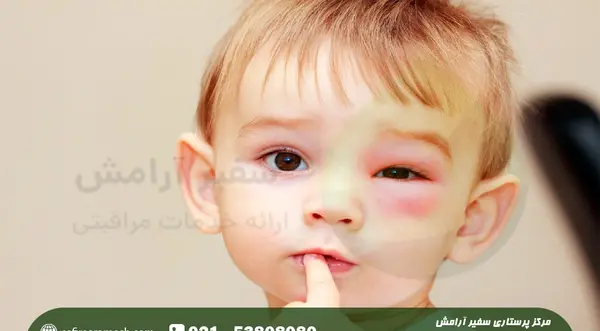 عکس از چشم عفونت کرده