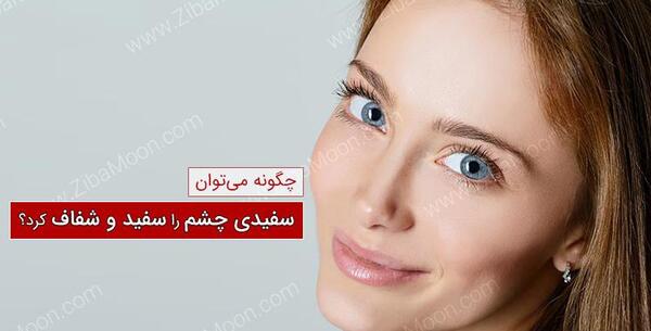 عکس دختر چشم سفید