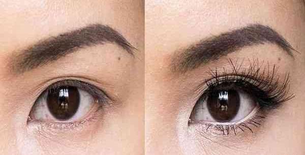 عکس چشم ژله ای بزرگ