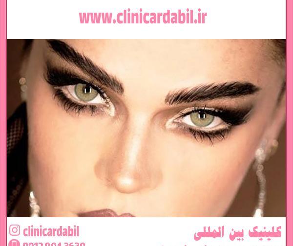عکس چشم ژله ای بزرگ