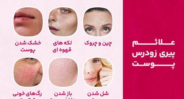 عکس بیماری پیری زودرس