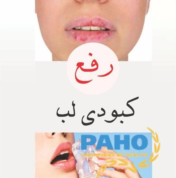 عکس کبودی دور لب