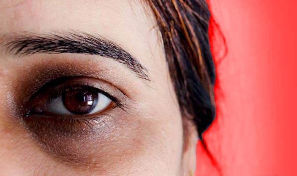 عکس کبودی دور لب