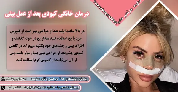 عکس کبودی دور لب
