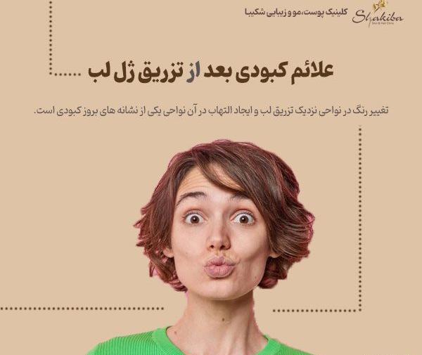 عکس کبودی دور لب