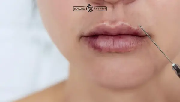 عکس کبودی دور لب