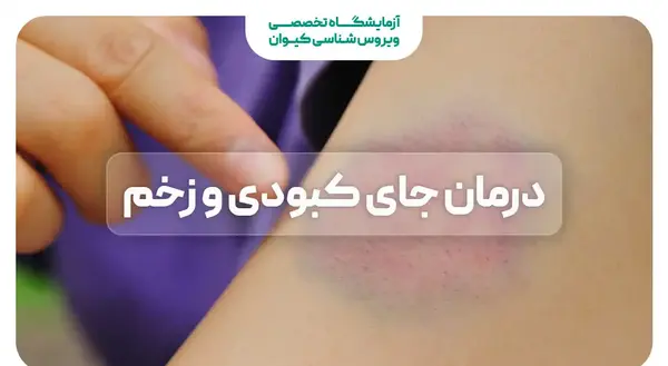 عکس کبودی روی کمر