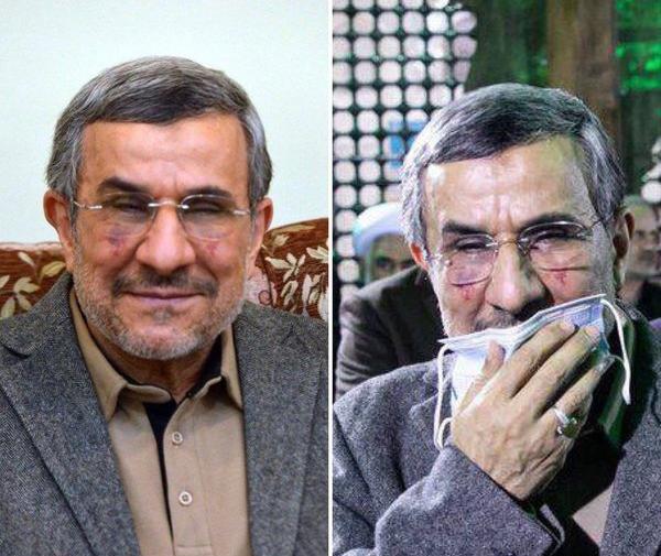 عکس صورت کبود احمدی نژاد