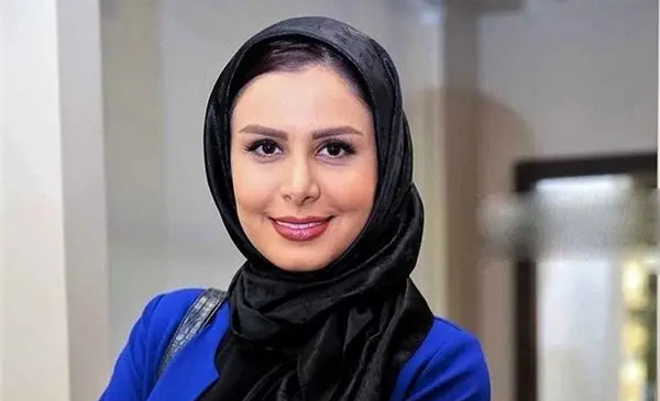 عکس صورت کبود احمدی نژاد