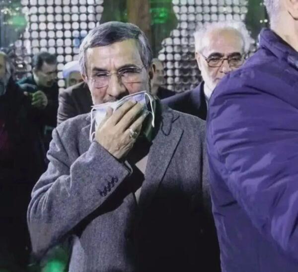 عکس صورت کبود احمدی نژاد