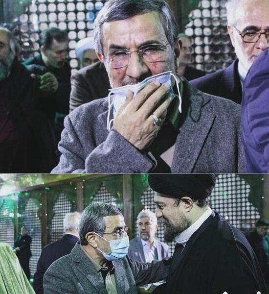 عکس صورت کبود احمدی نژاد