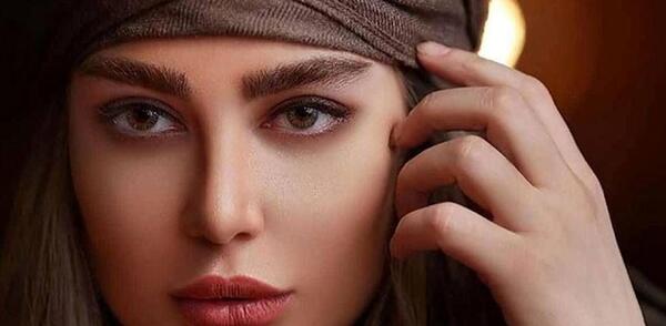 عکس صورت کبود احمدی نژاد