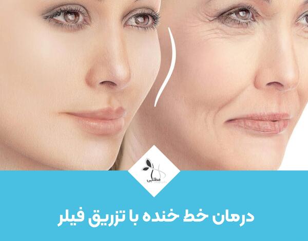 عکس فیک کبودی صورت