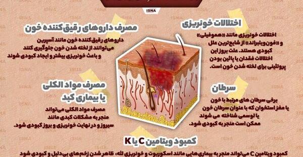 عکس کبودی بی دلیل بدن