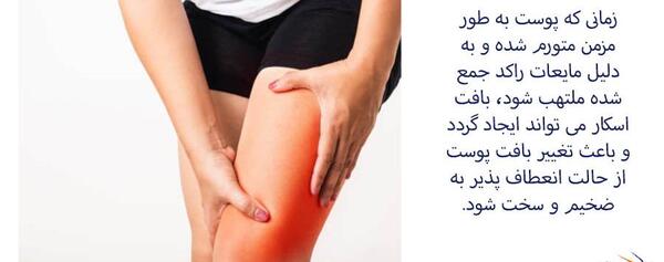عکس کبودی روی ران