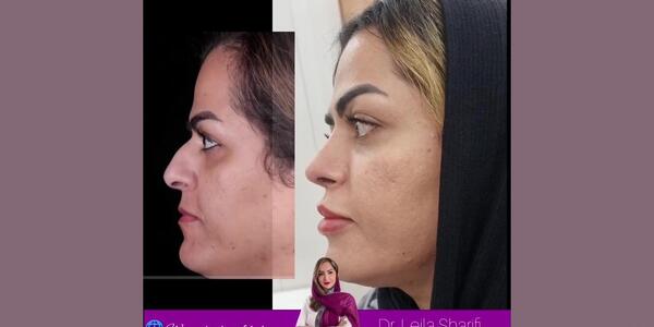 عکس دکتر رضا کبود خانی شیراز