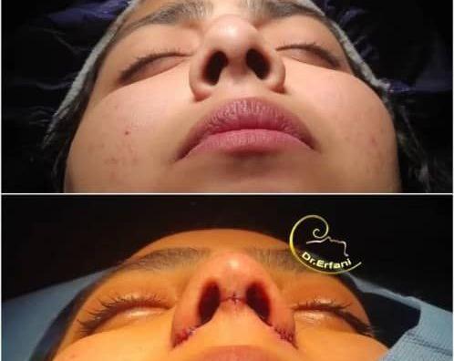 عکس عمل بینی دکتر کبودخانی