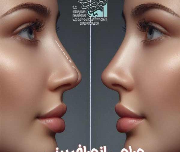 عکس عمل بینی دکتر کبودخانی