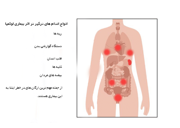 عکس کبودی های سرطان خون نی نی سایت