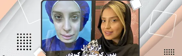عکس کبودی دست جای سرم
