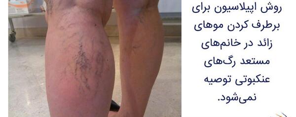 عکس کبودی ران پا نی نی سایت