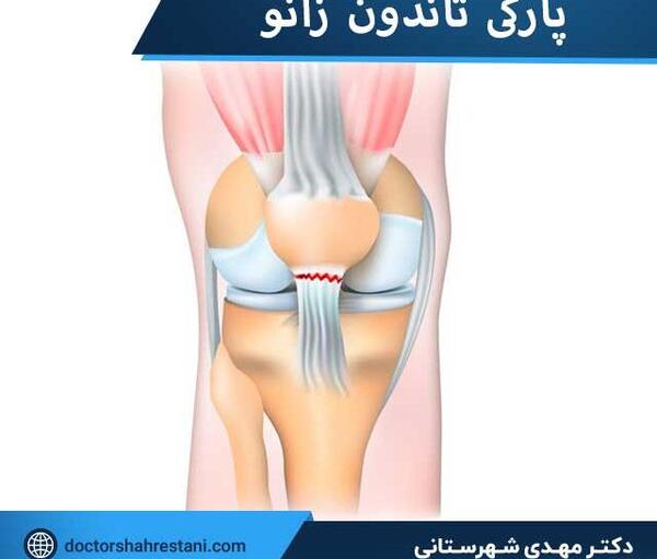 عکس کبودی ران پا نی نی سایت