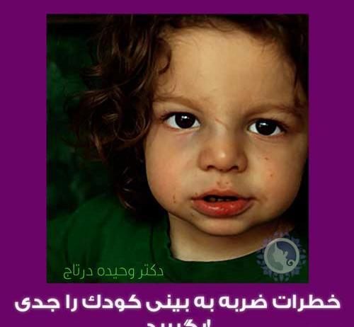 ضرب ديدگي عکس کبودی بدن در اثر ضربه