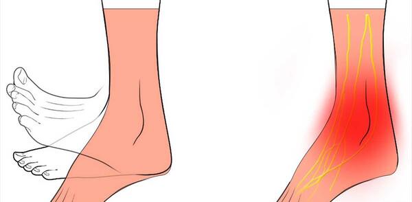ضرب ديدگي عکس کبودی بدن در اثر ضربه