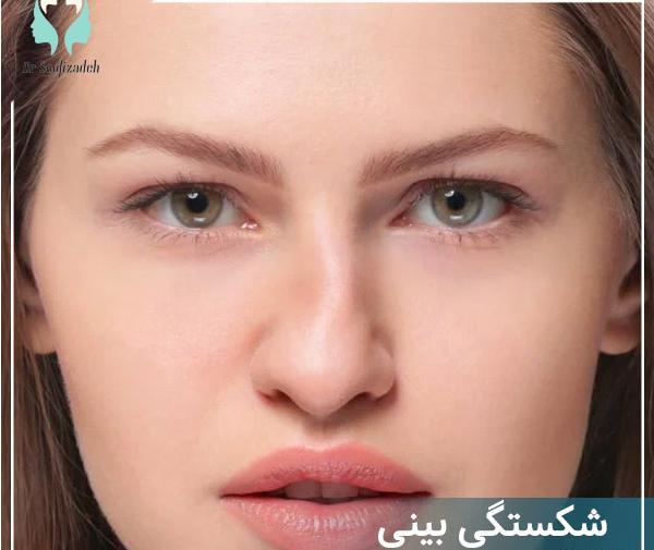 ضرب ديدگي عکس کبودی بدن در اثر ضربه
