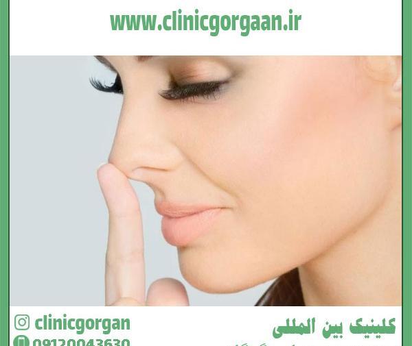 عکس کبودی گردن فیک