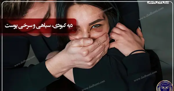 عکس کبودی گردن طبیعی