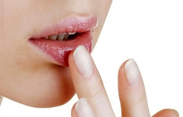 قلبی عکس کبودی لب نوزاد