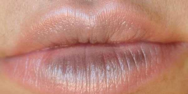 قلبی عکس کبودی لب نوزاد