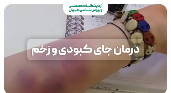 عکس کبودی گردن در اثر مکیدن