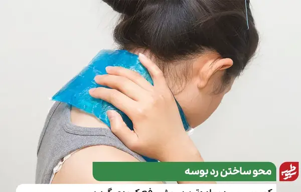 عکس کبودی گردن در اثر مکیدن