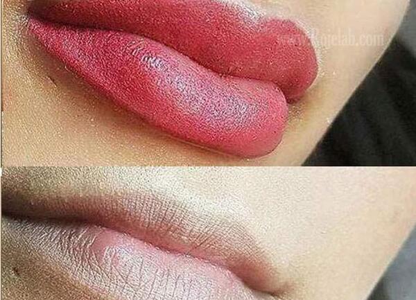 عکس مراحل پوسته ریزی تاتو لب