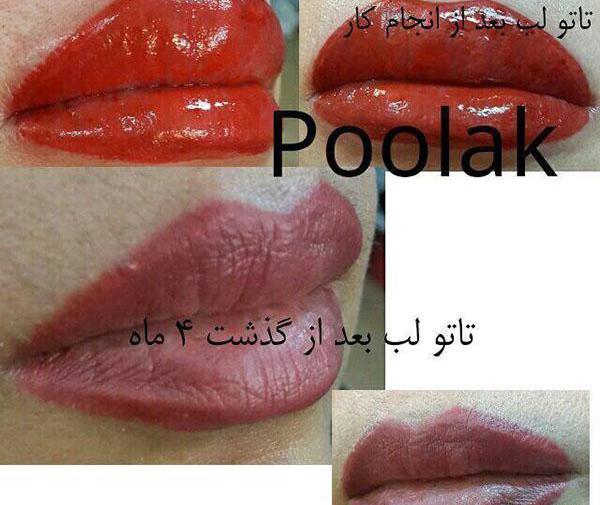 عکس مراحل پوسته ریزی تاتو لب