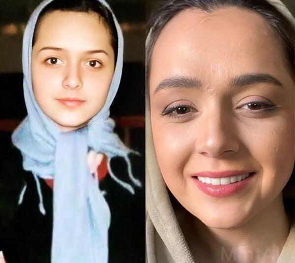 عکس های بچگی ترانه علیدوستی