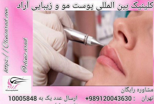 عکس تاتو لب گاز گرفته