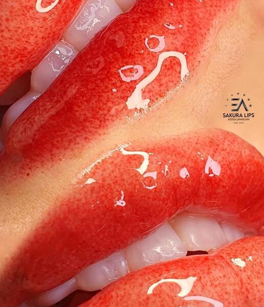 عکس تاتو لب گاز گرفته