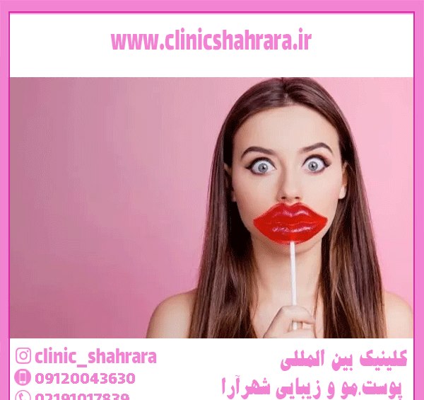 عکس تاتو لب گاز گرفته