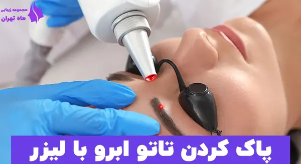 عکس قبل و بعد لیزر تاتو ابرو