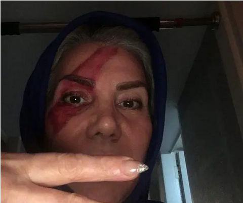 ترسناک ترین عکس تتلو