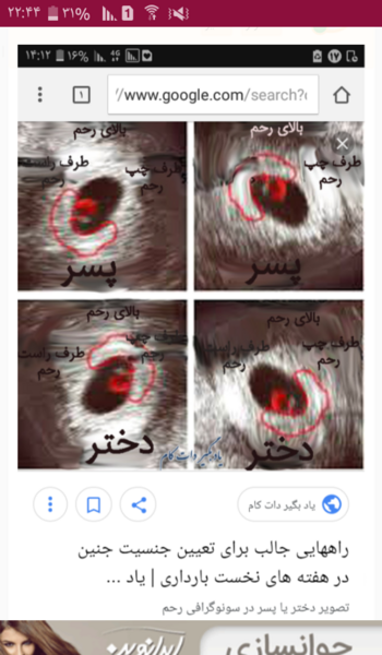 عکس جنین دوازده هفته پسر نی نی سایت