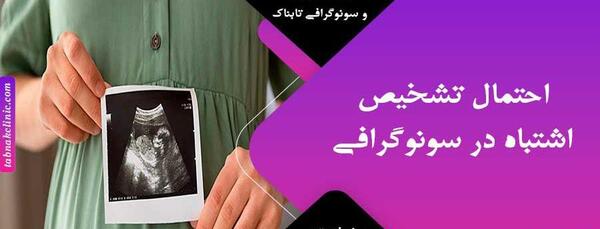 عکس جنسیت جنین دختر در سونوگرافی