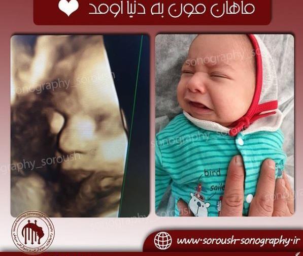 عکس از صورت جنین
