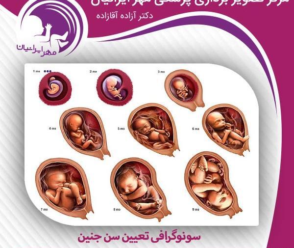 عکس از صورت جنین
